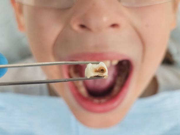 Best Emergency Pediatric Dental Care in Eaton Rapids, MI